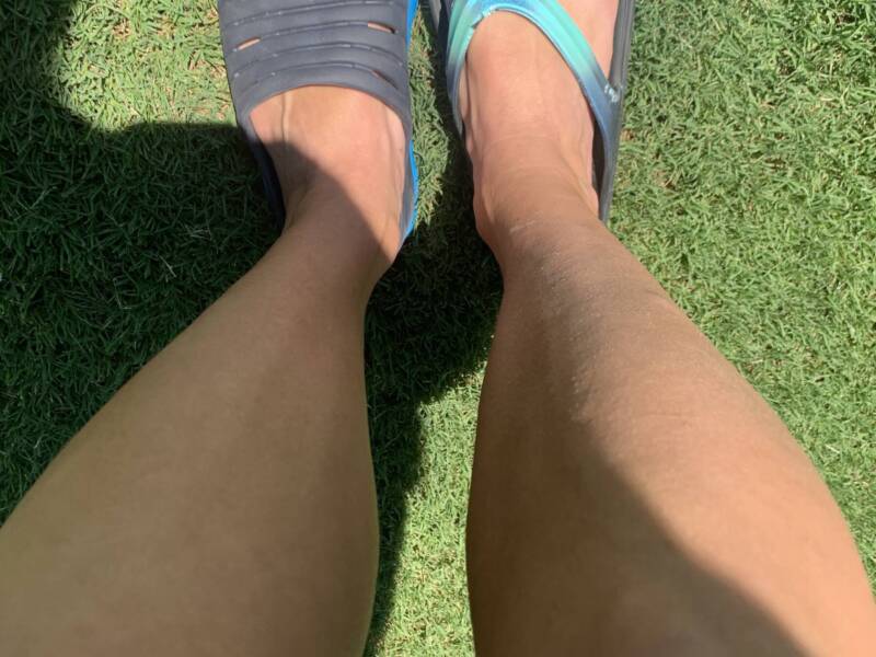 Overhead shot of one foot in a OOFOs sandal and the other in a Hoka slide.